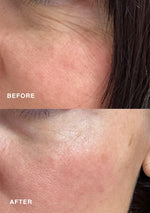 Before and after image showing results with Niki Newd® Skin Velvet – fine lines visible in the top image, smoother and softer skin below.