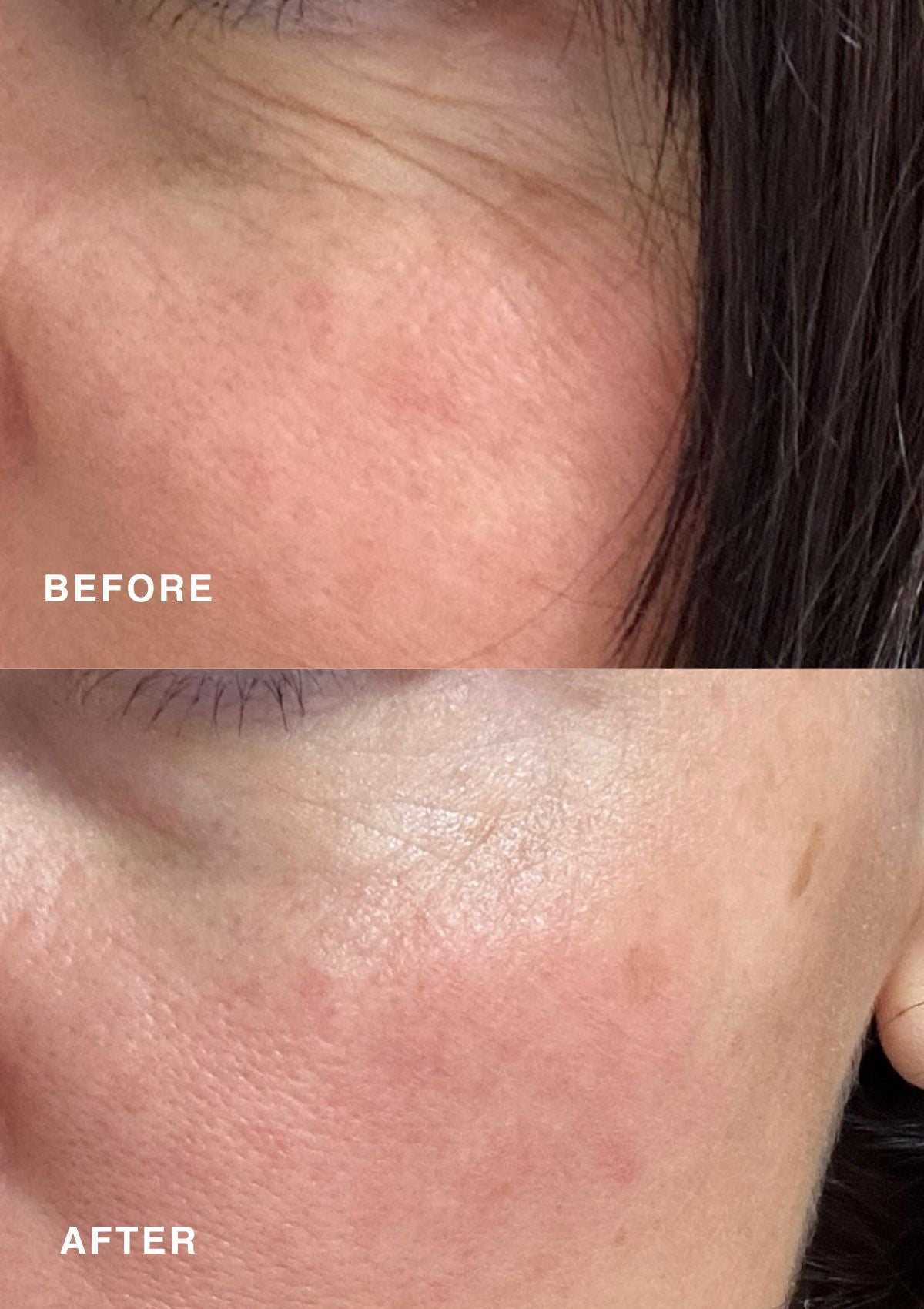 Before and after image showing results with Niki Newd® Skin Velvet – fine lines visible in the top image, smoother and softer skin below.