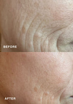 Before and after comparison showing results with Niki Newd® Skin Cream – in the top image skin appears dull with visible fine lines, in the bottom it looks smoother, brighter, and more radiant.