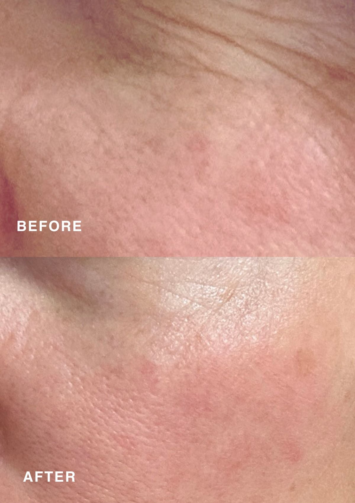 Before and after results with Niki Newd® Skin Butter – in the top image skin appears dull with visible fine lines, in the bottom it looks smoother, brighter, and naturally radiant.
